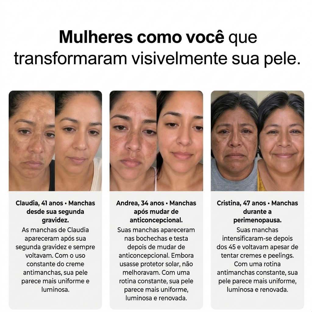 MelaClear Crema Renovadora